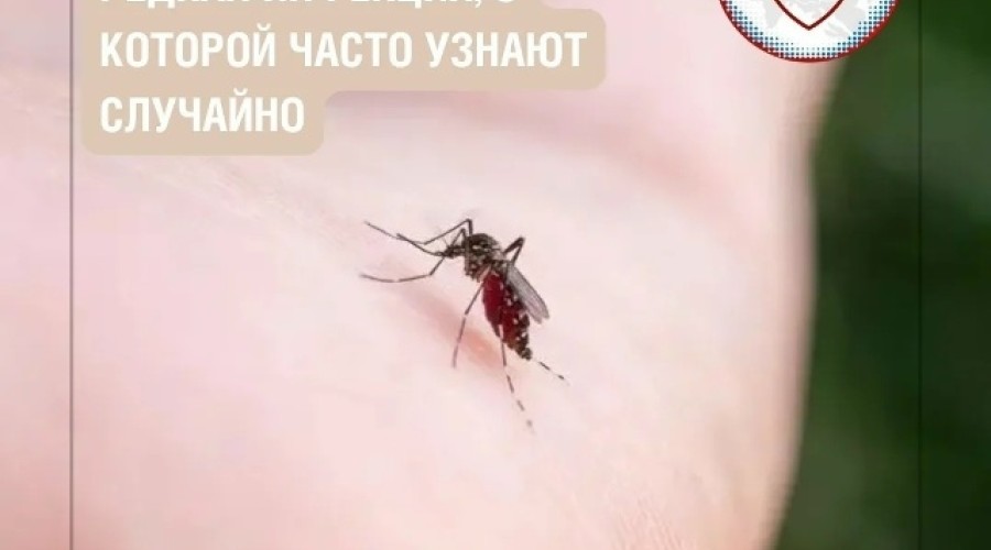 Дирофиляриоз: редкое паразитарное заболевание, передающееся через укусы комаров